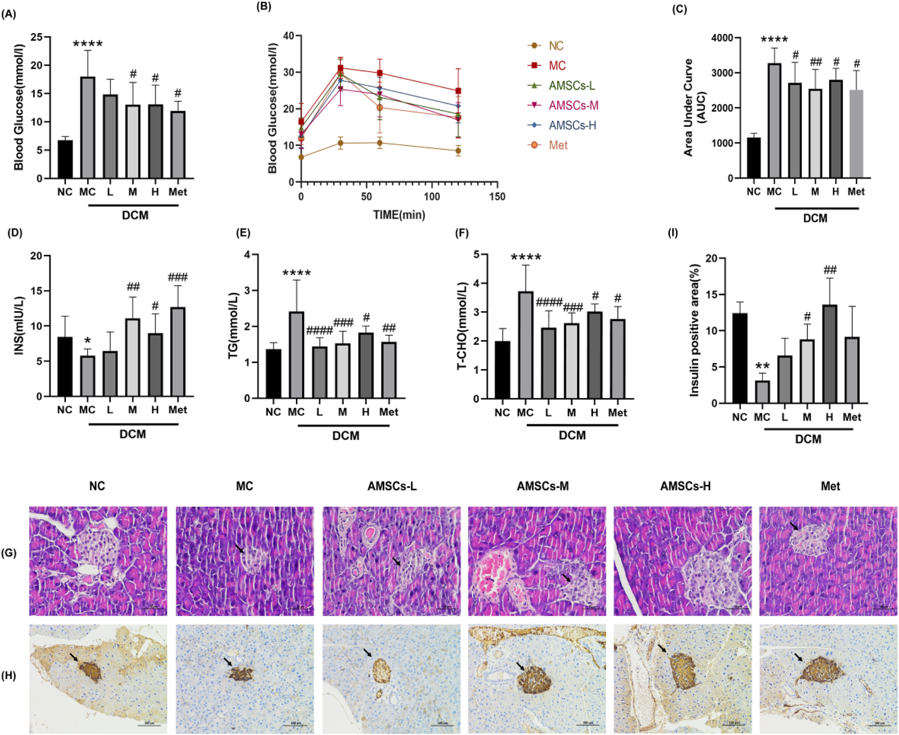 Graphs and histological images depict the effects of different treatments on diabetic cardiomyopathy (DCM). Graphs (A-F, I) show blood glucose, insulin, triglycerides, cholesterol levels, and insulin-positive areas. Histological images (G, H) display tissue samples under treatments NC, MC, AMSCs-L, AMSCs-M, AMSCs-H, and Met. The graphs illustrate statistical differences among groups, and the histological images highlight cellular changes.