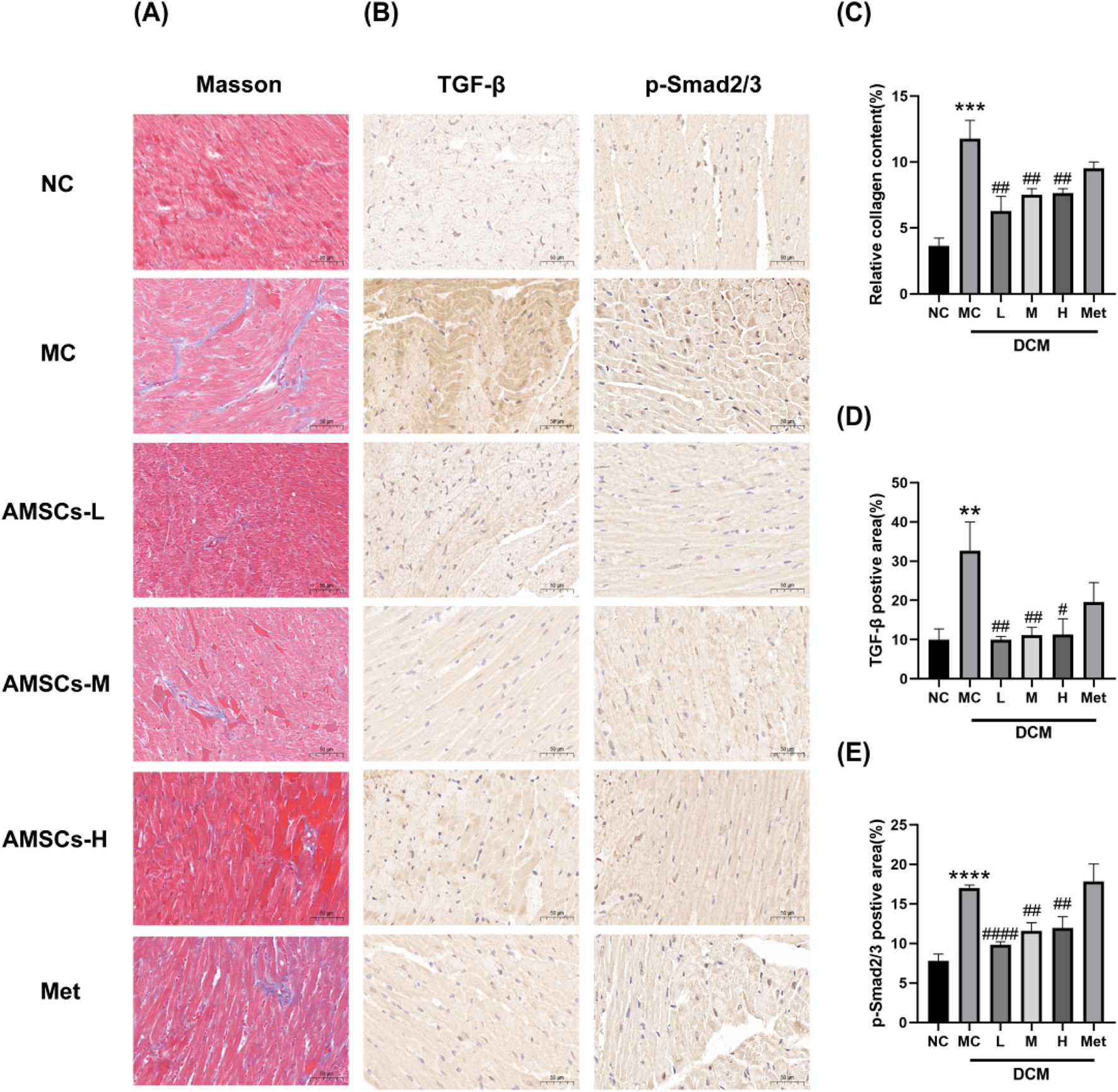 Histological and graphical comparison of cardiac tissue across different conditions. Panel A displays Masson trichrome staining, with rows labeled NC, MC, AMSCs-L, AMSCs-M, AMSCs-H, and Met. Panel B shows staining for TGF-β and p-Smad2/3. Panels C, D, and E contain bar graphs depicting relative collagen content and areas positive for TGF-β and p-Smad2/3, respectively, under these conditions, with significant differences marked by asterisks and hashes. Scale bars are present in the stained images.