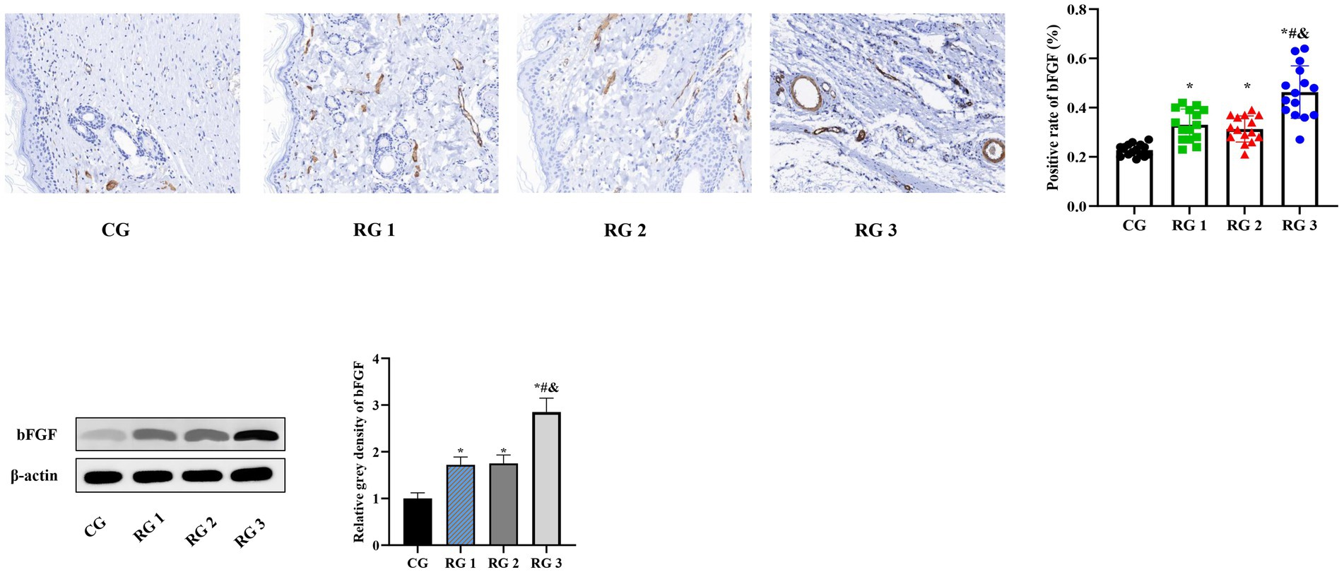 Histology images and graphs depicting the expression of bFGF in four groups: CG, RG1, RG2, and RG3. The first row shows histological slides with varying expression levels. The adjacent bar graph shows the positive rate of bFGF, increasing across groups, with RG3 having the highest. The second row includes a Western blot analysis for bFGF and β-actin, with corresponding bar graph showing relative gray density, again highest in RG3.