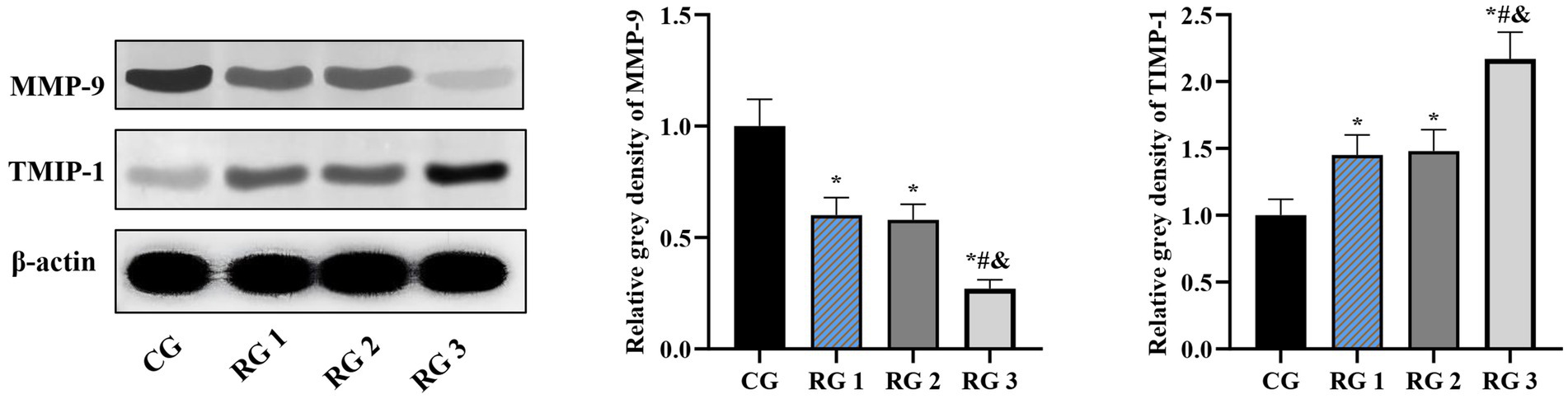 Western blot and bar graphs showing relative gray densities of MMP-9 and TIMP-1 across four groups: CG, RG1, RG2, and RG3. Left section displays protein bands for MMP-9, TIMP-1, and β-actin. Right section presents two bar graphs depicting relative densities, with RG3 noted as significant for changes in TIMP-1 and MMP-9 levels.