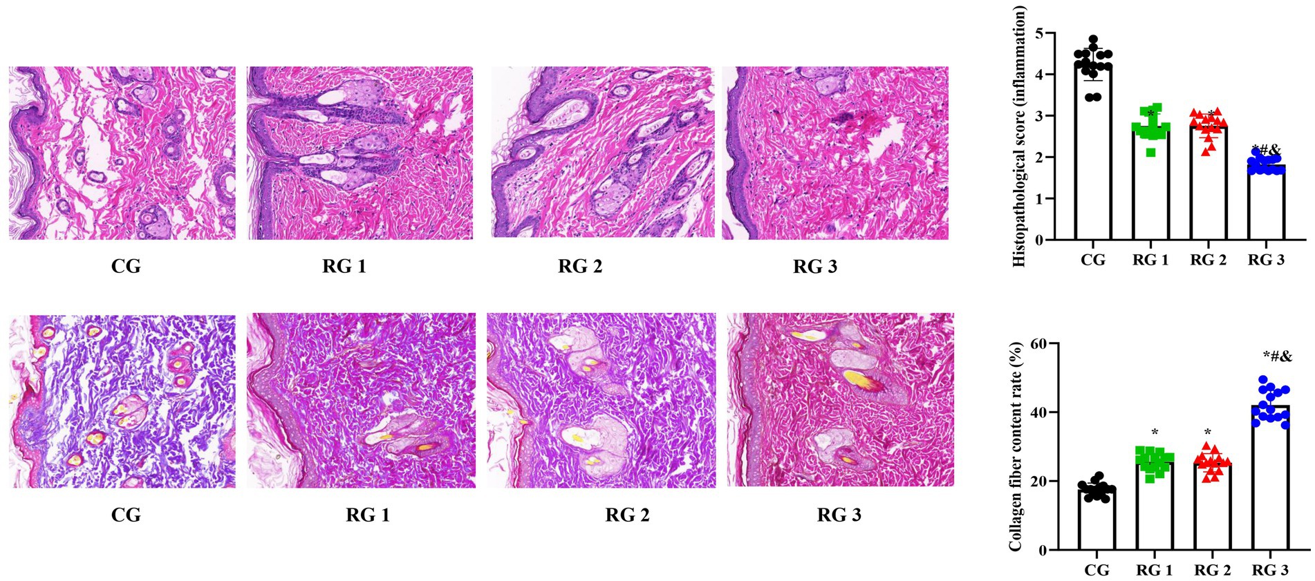 Histological images show tissue samples from CG, RG 1, RG 2, and RG 3, highlighting differences in inflammation and collagen content. Adjacent bar graphs depict histopathological scores and collagen fiber content percentage, with CG having higher inflammation and RG 3 showing higher collagen content.