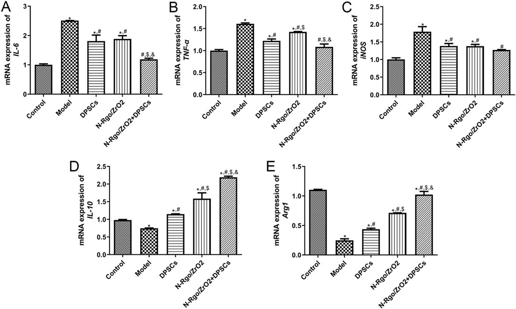 Bar graphs displaying mRNA expression levels of various markers: IL-6 (A), TNF-α (B), iNOS (C), IL-10 (D), and Arg1 (E). Different groups are compared, including Control, Model, DPSCs, N-Rgo/ZrO2, and N-Rgo/ZrO2+DPSCs. Each graph shows expression levels with statistical significance indicated by symbols *, #, $, and &.
