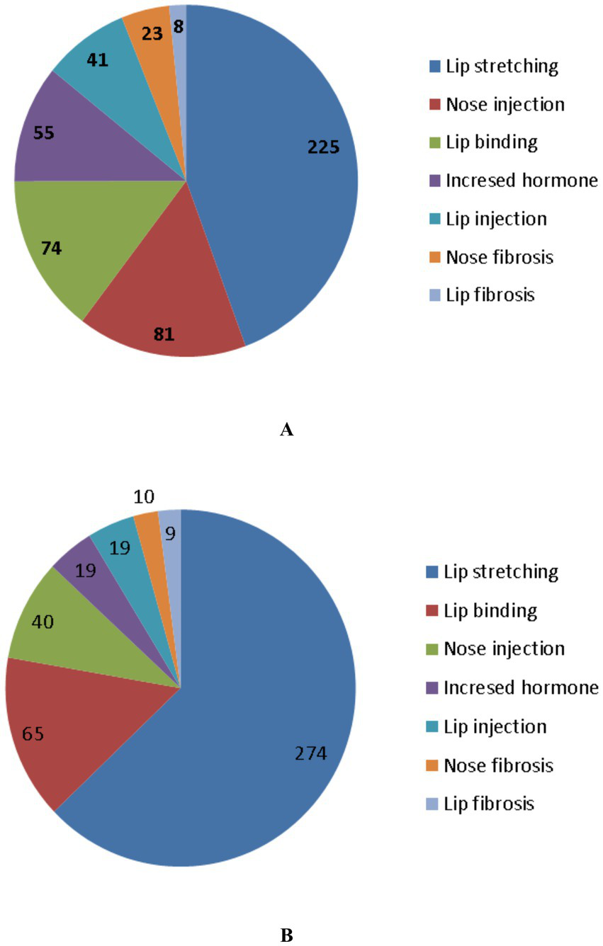 Two pie charts, labeled A and B, display different categories with corresponding values. Chart A shows categories: lip stretching (225), nose injection (81), lip binding (74), increased hormone (55), lip injection (41), nose fibrosis (23), and lip fibrosis (8). Chart B shows: lip stretching (274), lip binding (65), nose injection (40), increased hormone (19), lip injection (19), nose fibrosis (10), and lip fibrosis (9).