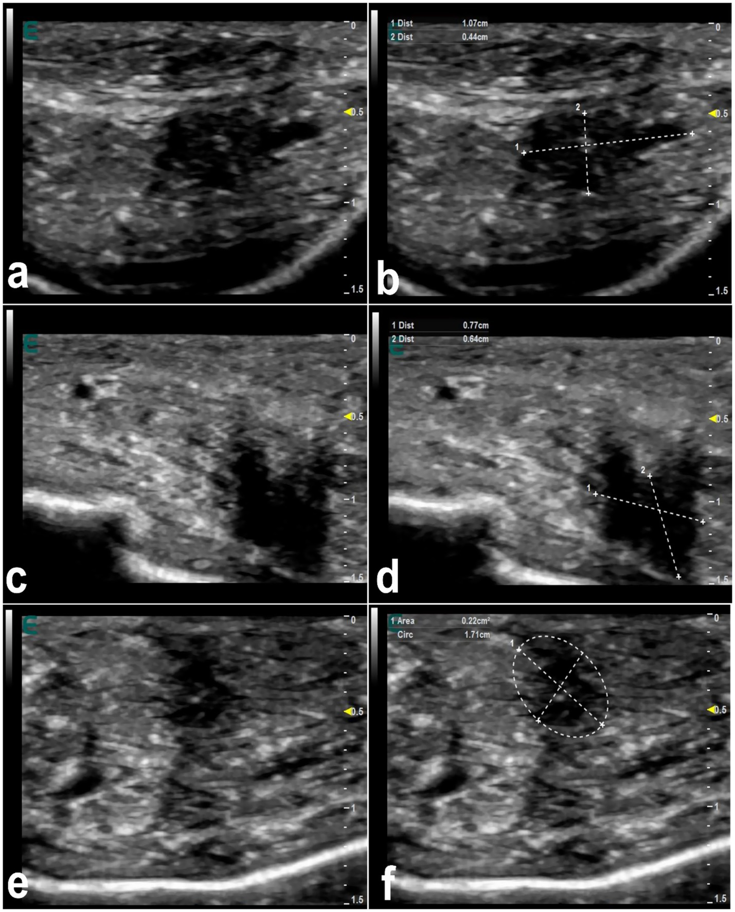 Ultrasound images showing different cross-sections marked with measurements. Image (a) and (c) show unmarked tissue structures. Image (b) and (d) include distance markers indicating specific measurements of 1.07 centimeters by 0.44 centimeters and 0.77 centimeters by 0.64 centimeters, respectively. Image (e) is similar to (c), without markers. Image (f) shows a marked area with circular measurement, indicating an area of 0.22 square centimeters and a circumference of 1.17 centimeters.