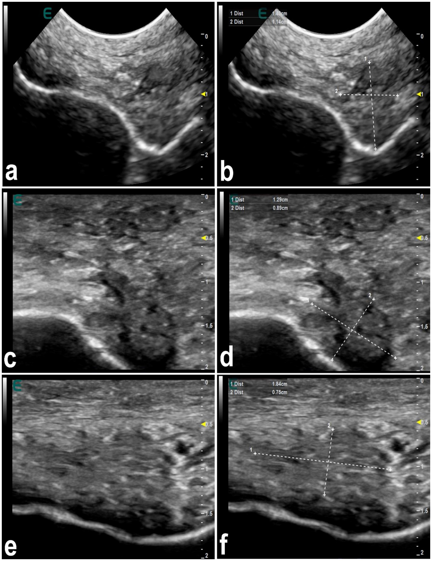 Ultrasound scans labeled a to f: a and b show a cross-sectional view with measurements labeled in b. c and d, e and f show linear views with a and two distance markings in d and f. Each scan displays tissue structure variations.