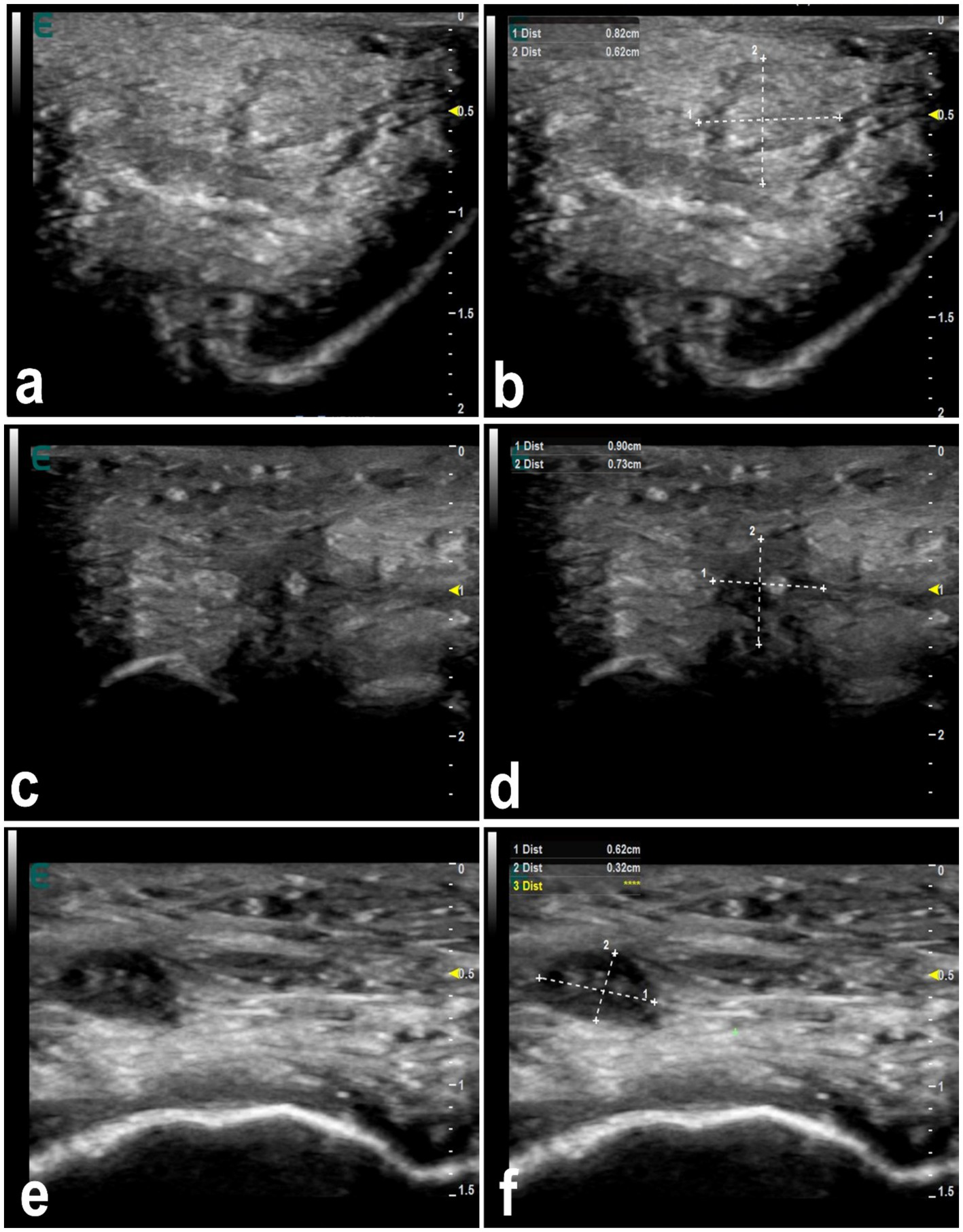 Ultrasound images labeled a to f show various cross-sectional views with measurements indicated by dotted lines and corresponding dimensions in centimeters. Each image captures different anatomical sections, displaying varying textures and densities typical of medical imaging, with numeric markers highlighting specific areas.