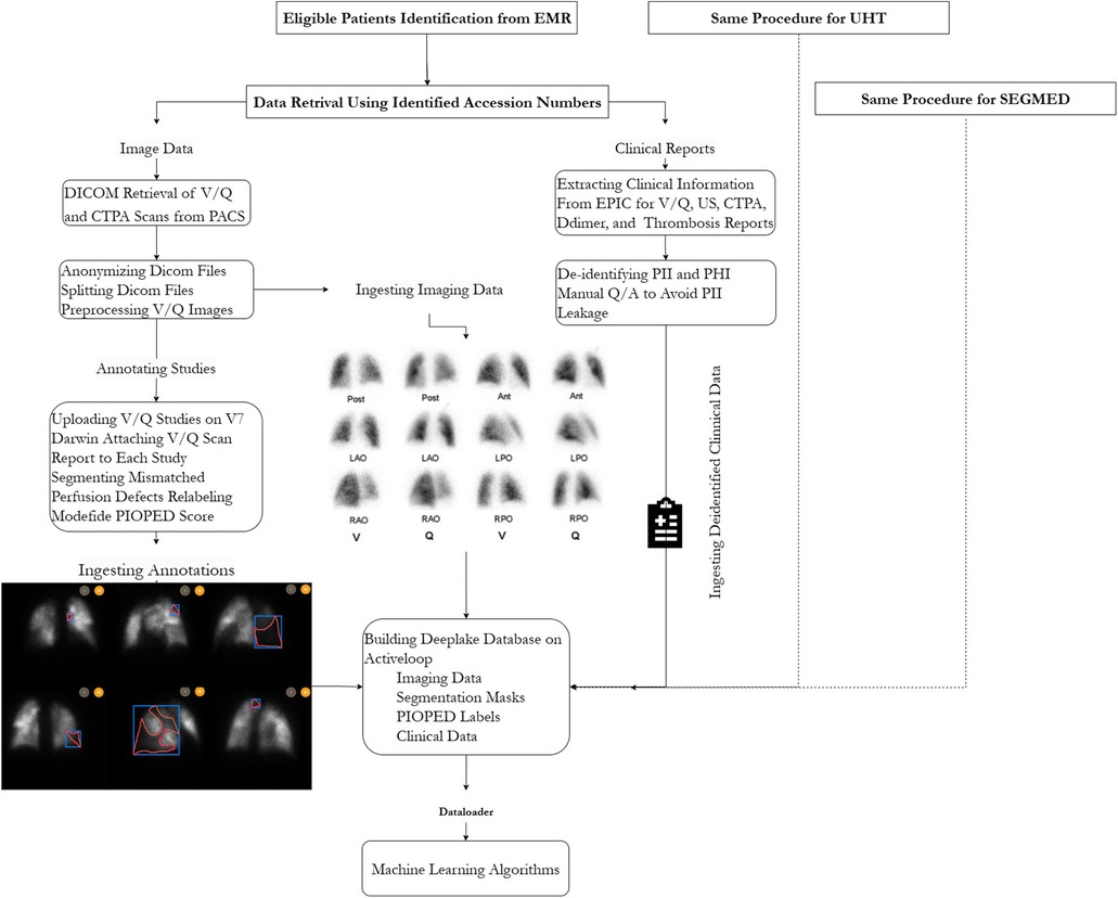 Flowchart illustrating a process for using data from electronic medical records (EMR) to train machine learning algorithms. It starts with identifying eligible patients and retrieving data using accession numbers, split into image and clinical data streams. Image data involves DICOM retrieval, anonymizing, processing, and annotating studies. Clinical data is extracted, de-identified, and combined with imaging data. Both streams feed into a Deeplake database, which is loaded into machine learning algorithms. The chart includes V/Q scans and segmentation masks.