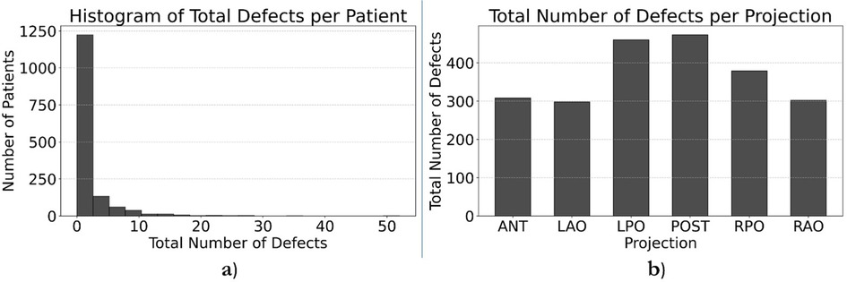 Two charts are presented. Chart (a) is a histogram showing the number of patients against total defects, with most patients having zero defects. Chart (b) is a bar graph showing total defects per projection, with LPO and POST having the highest defects among ANT, LAO, LPO, POST, RPO, and RAO.