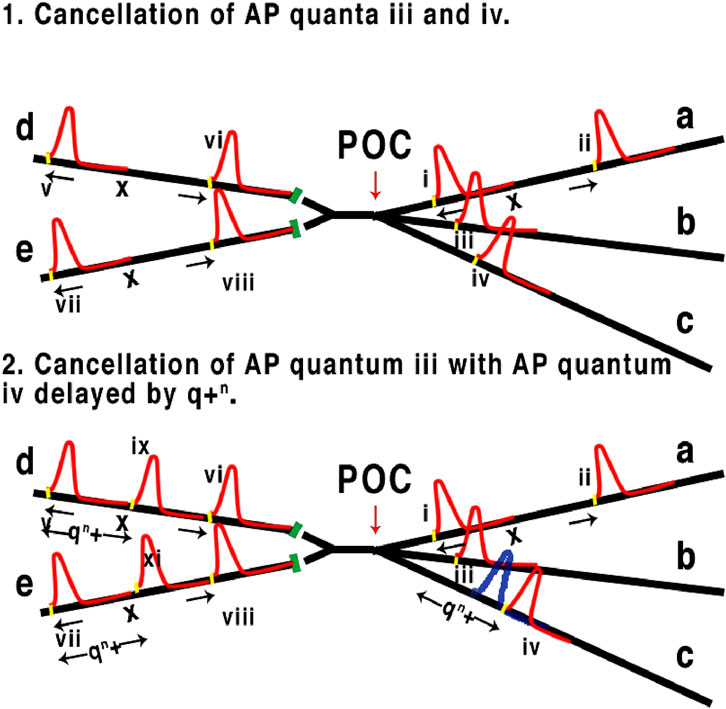 Diagram illustrating the cancellation of action potential quanta at two intersection points labeled POC, with numbered waves iii, iv, and others. Arrows indicate directions and delays labeled as \(x\) and \(q^n\). The setup includes pathways labeled a, b, c, d, e. The top panel shows direct cancellation, while the bottom panel depicts a delay in quantum iv.