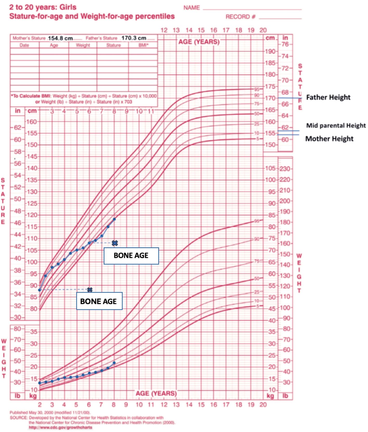 Growth chart for girls aged 2 to 20 showing stature- and weight-for-age percentiles with curved lines indicating different percentiles. A blue line follows a specific data set with annotations labeled “Bone Age.” Heights of parents and mid-parental height are marked on the right.