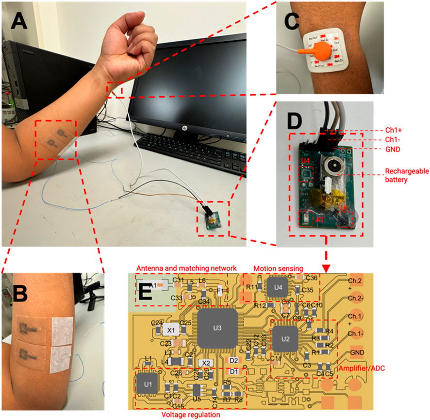 A multi-panel image shows a wearable electronic device setup. Panel A displays a person's arm, connected to a circuit via wires. Panel B highlights a close-up of bandages on the arm. Panel C shows the gel electrode connection. Panel D focuses on a circuit board with a rechargeable battery and various components labeled, including CH1+, CH1-, GND, U4, and U1. Panel E presents a diagram of the circuit board with sections for antenna and matching network, motion sensing, voltage regulation, and amplifier/ADC. Red dotted lines and labels indicate important features in each section.