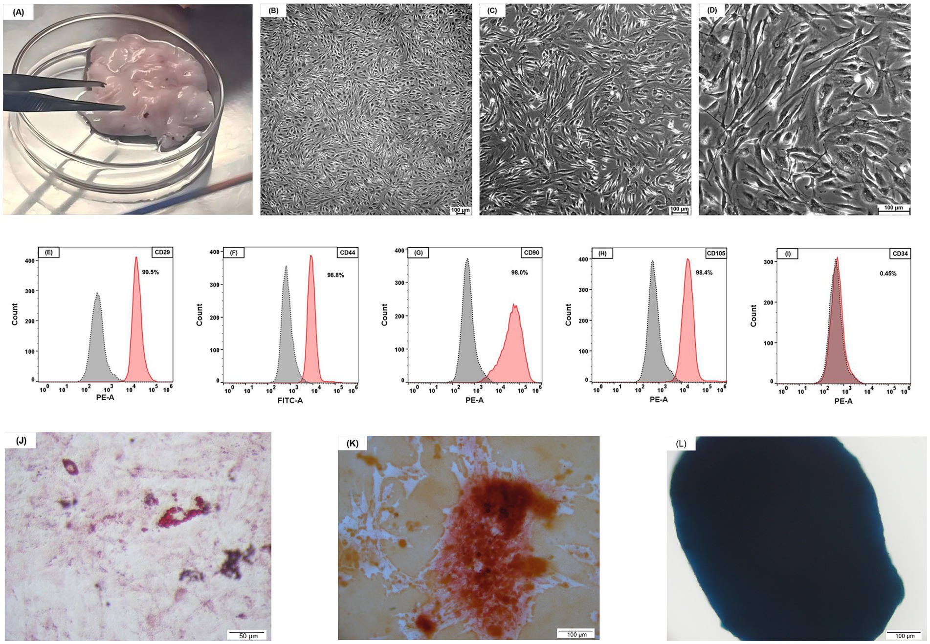 (A) Tissue sample in a dish held by tweezers. (B, C, D) Microscope images showing cell culture at different magnifications. (E-H) Flow cytometry histograms indicating expression levels of CD29, CD44, CD90, and CD105 with high positivity. (I) CD34 expression histogram with low positivity. (J) Microscopic image showing low magnification of stained sample. (K) Higher magnification of bone differentiation with intense red staining. (L) Sphere of cells stained blue indicating differentiation.