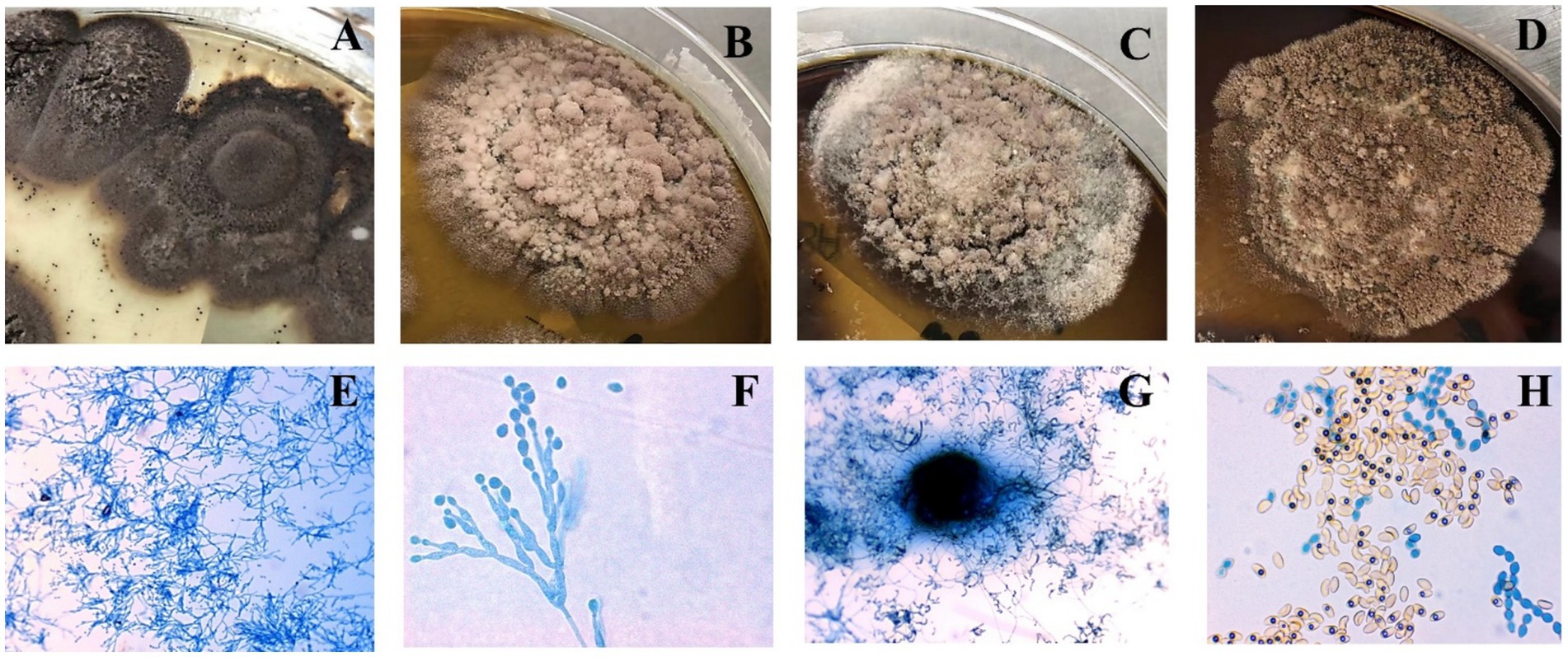 Panels A to D show fungal colonies with varying colorsand textures on petri dishes. Panels E to H display microscopic images offungal structures, lactophenol cotton blue staining revealed septate hyphae, basally swollen conidiophores, and chain-forming oval/pear-shaped conidia.
