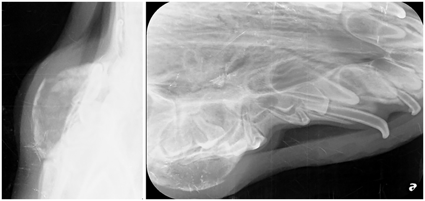 Two X-ray images depict a forearm fracture. The left image shows a lateral view with bone misalignment. The right image presents a detailed, angled perspective, highlighting overlapping bone structures and fracture lines.