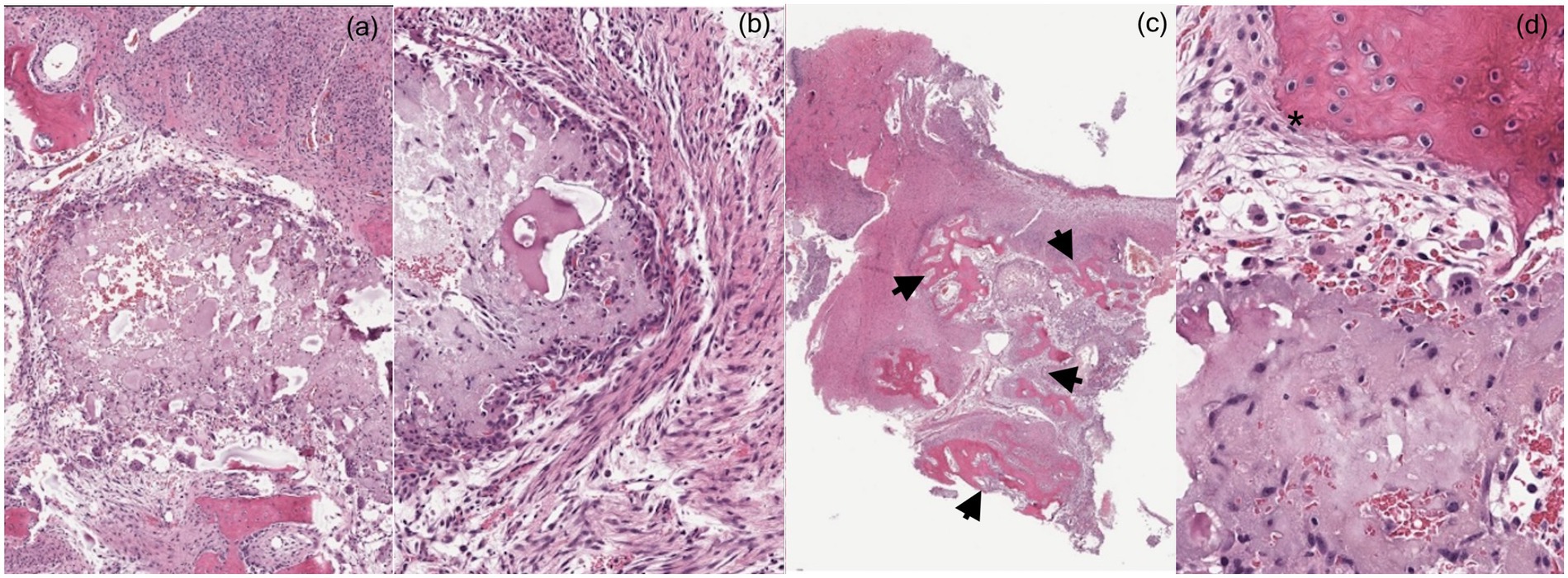 Four microscopic histological images labeled (a) to (d), showing various tissue samples stained in shades of pink and purple. Image (a) shows a rounded tissue structure with cellular detail. Image (b) displays elongated cellular formations. Image (c) features irregular shapes with arrow indicators pointing to specific areas. Image (d) highlights a structure marked with an asterisk, surrounded by dense cellular patterns.