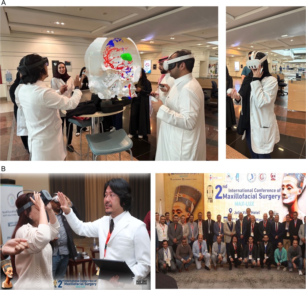 Composite figure showing virtual reality (VR) applications in medical training during the 2nd International Conference of Maxillofacial Surgery. Panel A includes two images: on the left, a group of participants interact with a 3D holographic skull using mixed reality headsets; on the right, individual participants engage with VR headsets. Panel B shows a conference attendee receiving guidance while using a VR headset (left) and a group photo of participants and organizers in front of a conference banner (right).