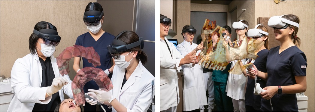 Two-panel image showing the use of mixed and virtual reality for dental and maxillofacial training. In the left panel, three clinicians wearing mixed reality headsets examine 3D holographic models of upper and lower dental arches while performing a simulated intraoral procedure on a patient. In the right panel, a group of healthcare professionals, wearing either mixed or virtual reality headsets, interact with a detailed 3D holographic model of a human maxilla and mandible in a collaborative educational setting.