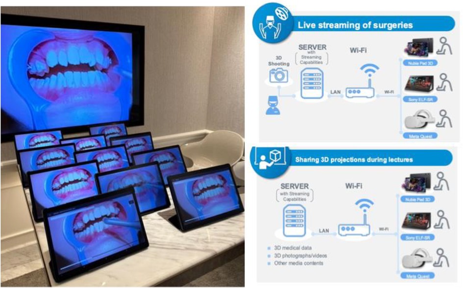 Multiple tablet screens display a dental procedure with an open mouth on a large monitor. Adjacent, an infographic illustrates live surgery streaming and 3D projection sharing, showcasing a server connected via LAN and Wi-Fi to devices like Nubia Pad 3D, Sony ELF-SR, and Meta Quest.
