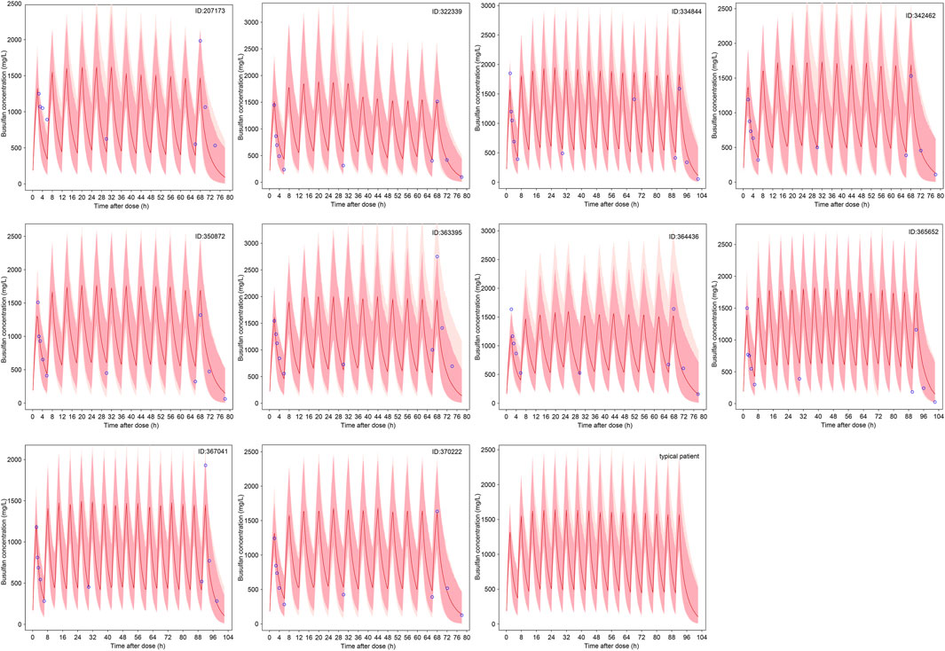 Eleven line graphs display busulfan concentration over time after dose for different patients, with individual data points marked. Each graph shows variability in concentration peaks and troughs, with a shaded area representing variance. The graphs include patient IDs like 207173, 322339, and more, concluding with a