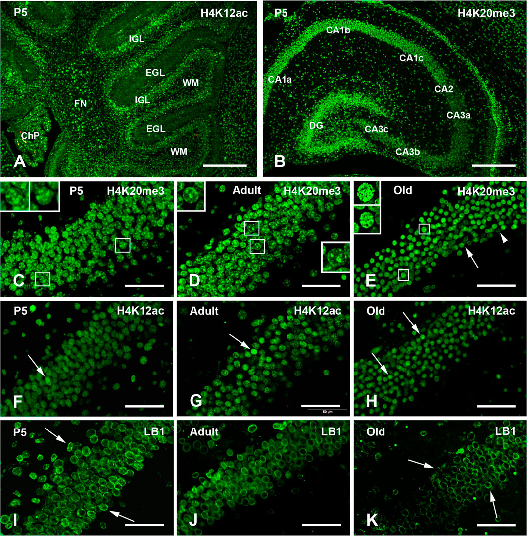 Fluorescence microscopy images show brain sections labeled with various markers. Panels A and B display a cerebellum and a hippocampus stained in green for H4K12ac and H4K20me 3 respectively. Panels C to K show the hippocampus stained for H4K20me3, H4K12ac, and LB1 at different developmental stages. Inserts highlight specific cells. Scale bars provide size reference.