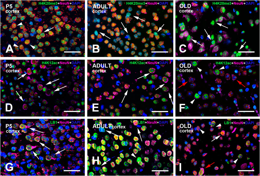Nine-panel fluorescence microscopy image showing brain cortex sections from P5, adult, and old mice. Panels A-C depict H4K20me3, NeuN, and DAPI staining. Panels D-F show H4K12ac, NeuN, and DAPI staining. Panels G-I illustrate LB1, NeuN, and DAPI staining. Arrows indicate regions of interest, highlighting variations in staining patterns among different age groups. Each panel is labeled with the corresponding age and markers.