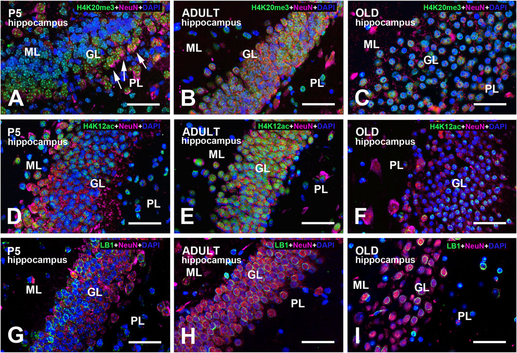 Fluorescence microscopy images of hippocampal regions in P5, adult, and old samples. Panels A, B, C display H4K20me3, NeuN, and DAPI staining; panels D, E, F show H4K12ac, NeuN, and DAPI; panels G, H, I depict LB1, NeuN, and DAPI. Each row represents different stages, highlighting molecular markers in dentate gyrus regions: molecular layer (ML), granule cell layer (GL), and polymorphic layer (PL). Scale bars are visible in each image.