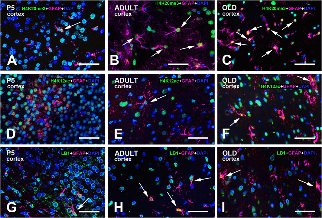 Fluorescent microscopy images of mouse cortex sections at different ages: P5, adult, and old. Each panel shows specific markers: H4K20me3, H4K12ac, and LB1, labeled in green, with GFAP in red and DAPI in blue. Arrows highlight regions of interest. Panels A-C display H4K20me3, D-F show H4K12ac, and G-I illustrate LB1 expressions. These images compare cellular compositions and marker expressions across developmental stages.