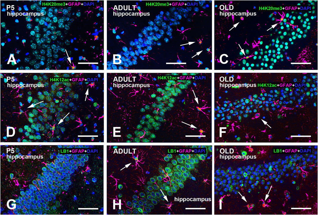 Fluorescent microscopy images showing hippocampal tissues at different life stages: P5, adult, and old. The tissues are stained for H4K20me3, H4K12ac, LB1, GFAP, and DAPI, showing various cellular and structural changes with age. Panels A, B, and C demonstrate H4K20me3 staining, panels D, E, and F show H4K12ac, while panels G, H, and I illustrate LB1 staining. Each stage displays distinct patterns with arrows indicating specific features. Scale bars are present in each panel.