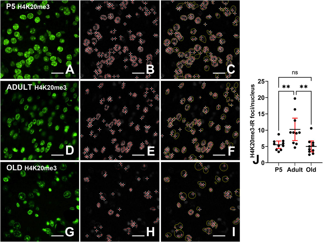 Fluorescent microscopy images showing H4K20me3 nuclear staining at different life stages: P5, Adult, and Old. Images A, D, and G display green-stained nuclei; B, E, and H show nuclear foci with red marks; C, F, and I highlight nuclei outlines with yellow annotations. A bar graph (J) compares H4K20me3-IR foci per nucleus across stages, with significant differences between P5 and Adult, Adult and Old, while P5 and Old are not significantly different. Scale bars are present in each image.