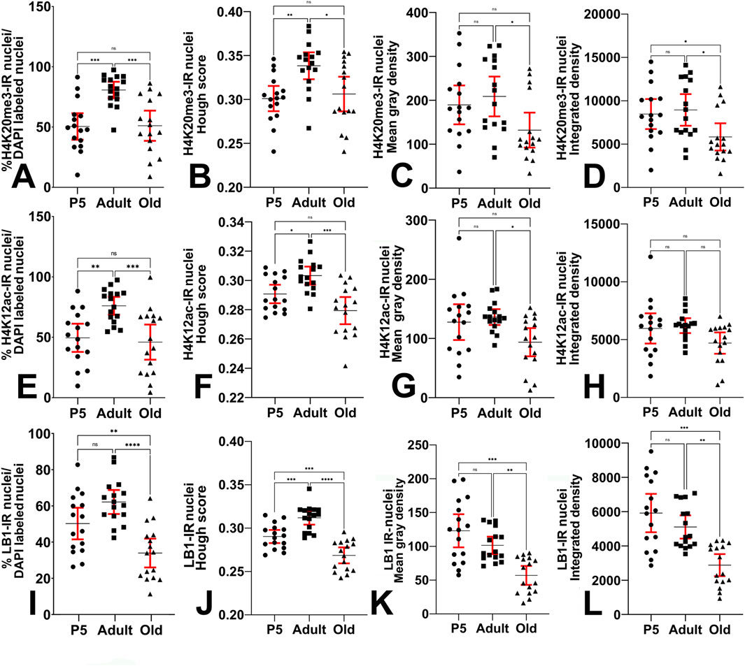Twelve scatter plots labeled A to L compare various parameters of P5, Adult, and Old samples. Each plot depicts individual data points with mean and standard deviation indicated by red bars. Statistical significance is denoted by asterisks. Parameters include percent labeled nuclei, Hough score, mean gray density, and integrated density for H4K20me3, H4K12ac, and LB1 markers.