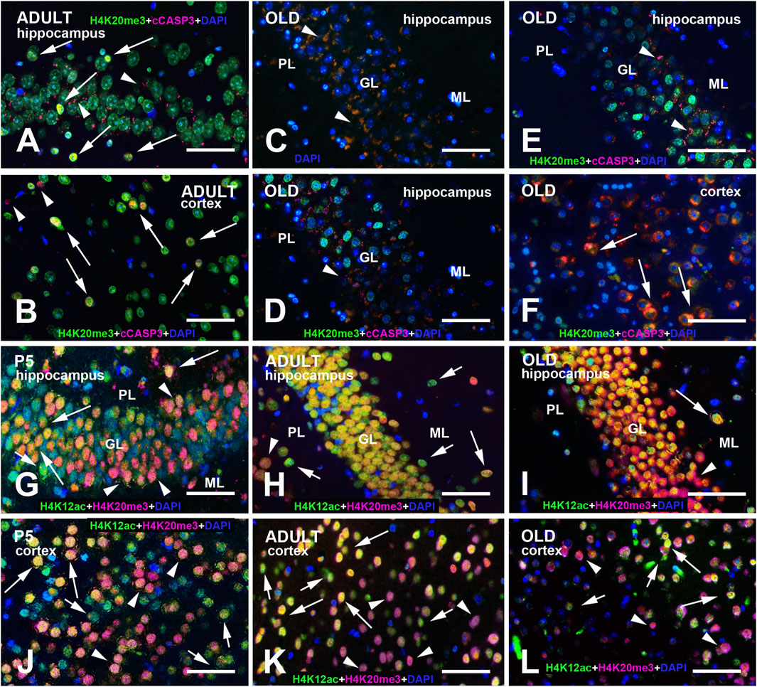 Fluorescent microscopy images showing cellular composition in the hippocampus and cortex across developmental stages: P5, adult and old. Panels A-F highlight markers H4K20me3, cCASP3, and DAPI. Panels G-L show H4K12ac, H4K20me3, and DAPI markers. Arrows indicate specific cellular features. Each panel is labeled with age, region, and specific markers used.