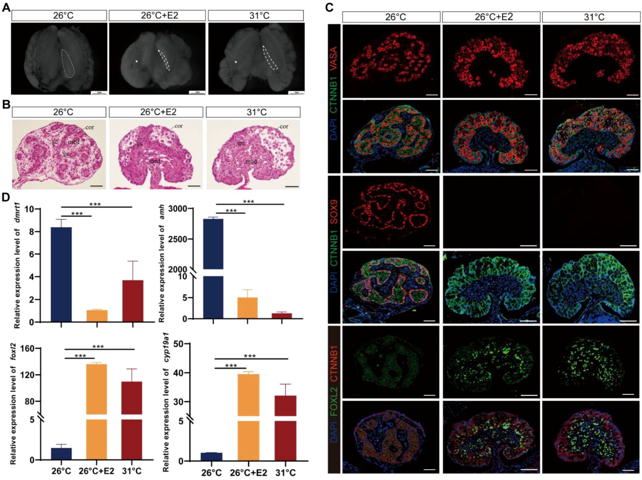 Panel A shows images of samples under different conditions: 26°C, 26°C with E2, and 31°C. Panel B displays histological cross-sections of the samples under the same conditions. Panel C contains fluorescent images illustrating the expression of VASA, CTNNB1, SOX9, and FOXL2 among others, across the different conditions. Panel D presents bar graphs comparing the relative expression levels of genes dmrt1, amh, foxl2, and cyp19a1 under the three conditions, highlighting significant differences.
