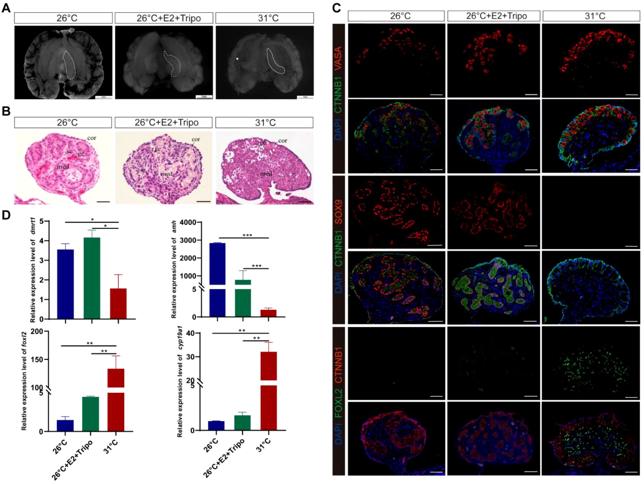 Panel A shows three MRI images of brain sections under different conditions: 26°C, 26°C with E2 and Tripo, and 31°C. Panel B contains histological sections of tissue at the same conditions, labeled with “cor,” “gc,” and “med.” Panel C presents immunofluorescence images displaying protein markers VASA, CTNNB1, SOX9, and FOXI2, with DAPI staining. Panel D includes bar graphs showing the relative expression levels of dmrt1, amh, foxl2, and cyp19a1 across the conditions, with various significance markers indicated.