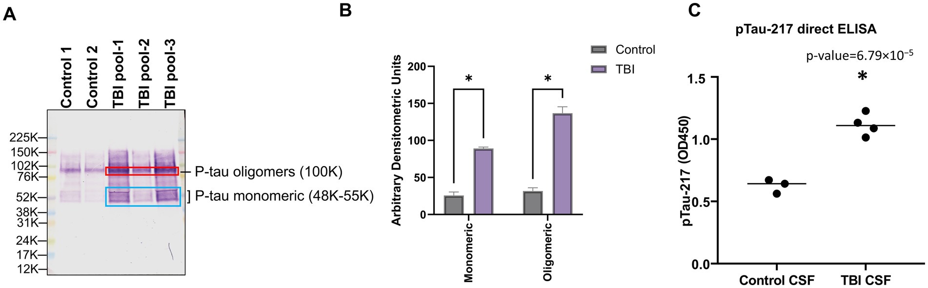 Panel A shows a Western blot analysis comparing P-tau oligomers (100K) and monomeric P-tau (48K-55K) across various samples labeled as Control 1, Control 2, and TBI pools 1-3. Panel B is a bar graph illustrating significant increases in both monomeric and oligomeric P-tau in TBI samples compared to controls. Panel C shows a scatter plot from a pTau-217 direct ELISA with a p-value of 6.79 x 10^-5, indicating a higher pTau-217 level in TBI CSF samples compared to controls.