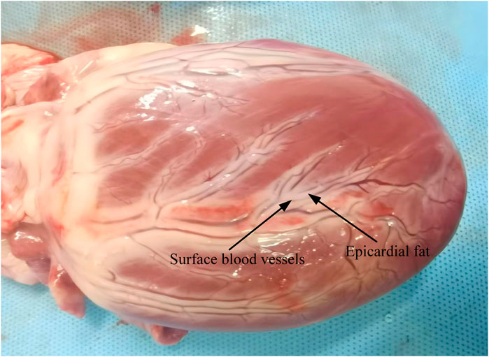 Close-up of a heart showing surface blood vessels and epicardial fat. Thin blood vessels are visible on the pinkish heart muscle, with clear labels indicating their presence. The image provides a detailed view of cardiac anatomy.