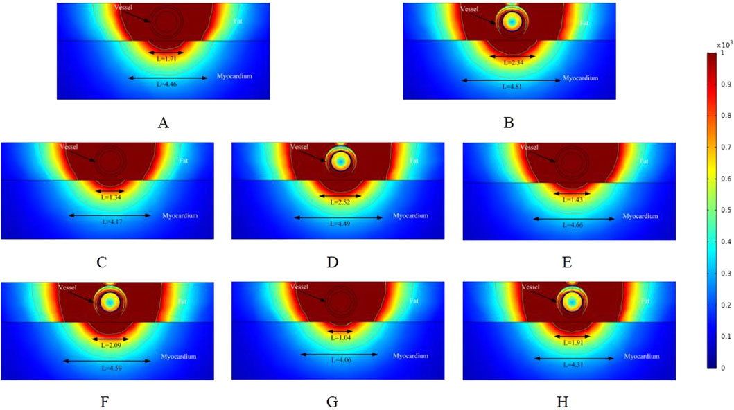 Color-coded heat maps labeled A to H display the vessel, fat, and myocardium layers. Each map shows measurements of L-values overlaid on the layers, with a vertical color scale ranging from zero to one point zero three on the right side.