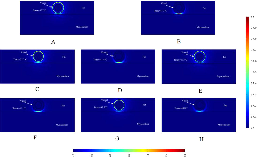 Thermal images labeled A to H show a vessel, fat, and myocardium with varying temperature maxima from 37.7 to 43.3 degrees Celsius, color-coded by a temperature scale.