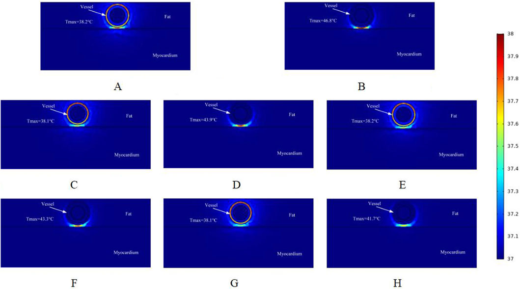 Thermal images labeled A to H show the cross-section of a tissue with a vessel, fat layer, and myocardium. The maximum temperatures for each image range from 38.1°C to 46.8°C, indicated next to the vessel. A color scale on the right shows temperature variations from 37°C to 38°C.