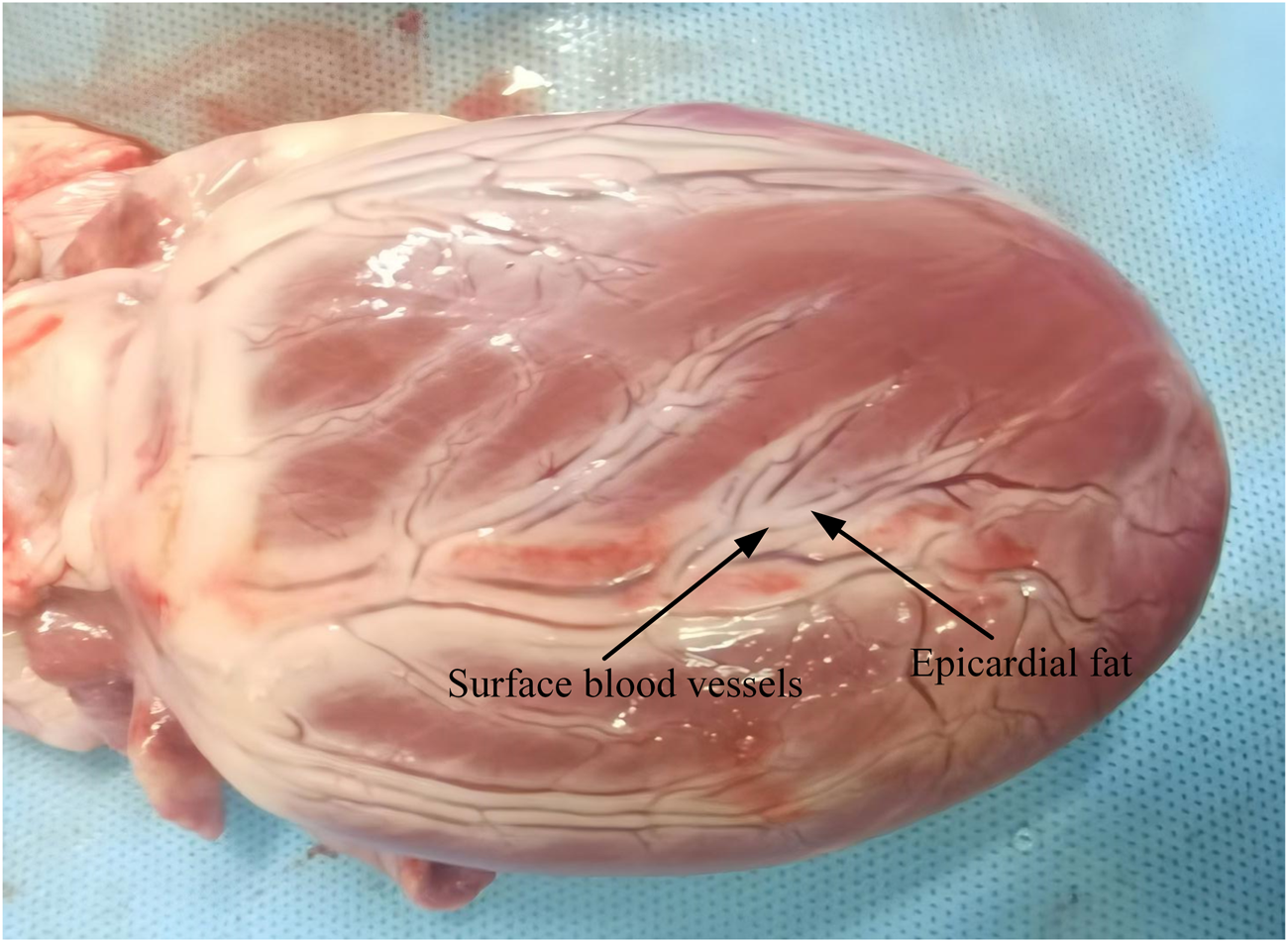 Close-up of a heart showing surface blood vessels and epicardial fat. Thin blood vessels are visible on the pinkish heart muscle, with clear labels indicating their presence. The image provides a detailed view of cardiac anatomy.