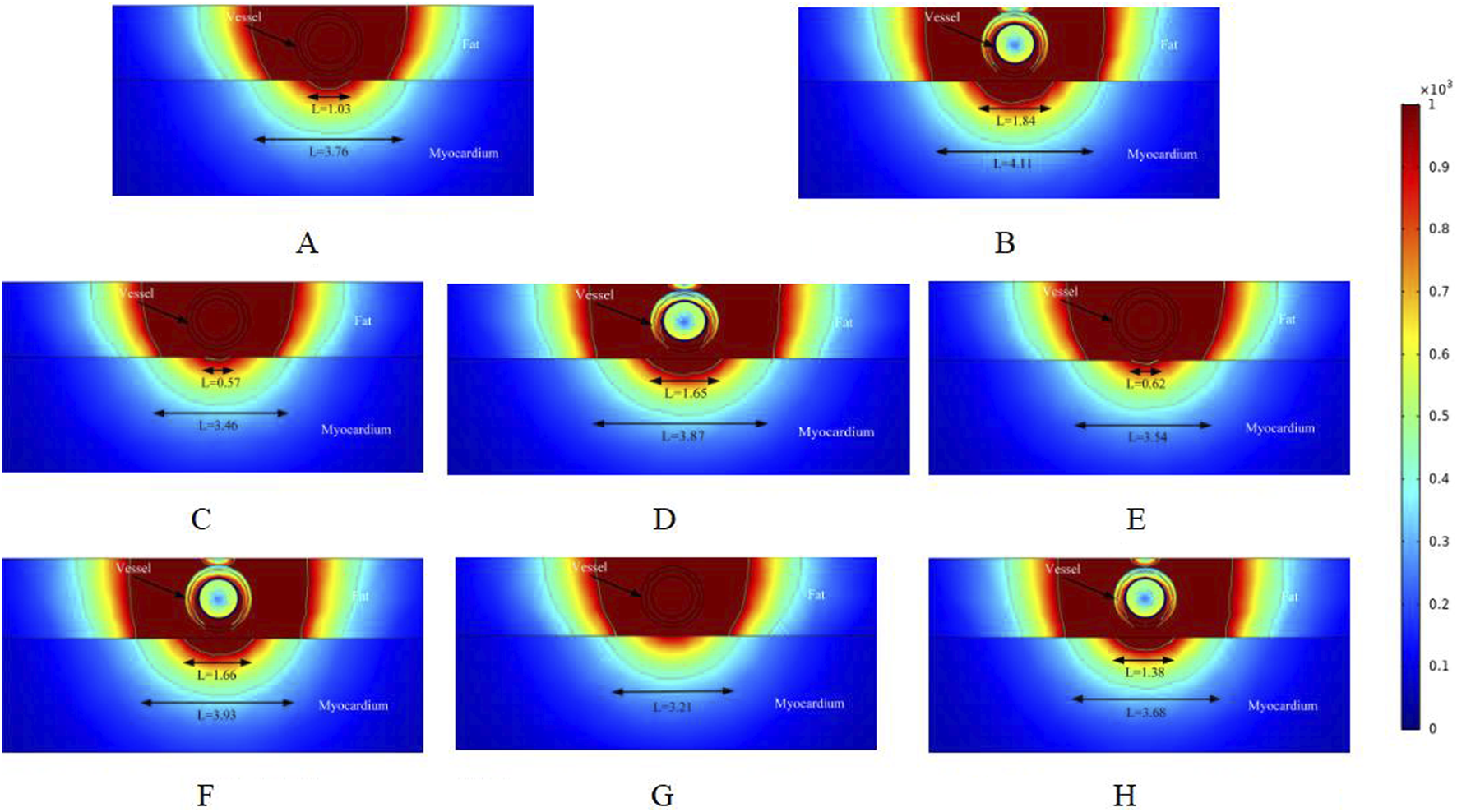 Simulations A to H show heat distribution in layers labeled vessel, fat, and myocardium. Colors range from red to blue, indicating temperature gradients. An arrow next to each panel indicates distance in centimeters. A color bar on the side represents the scale from 0 to 1 multiplied by 10^3.