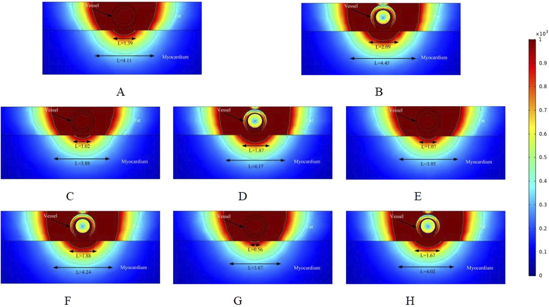 Eight thermal distribution diagrams labeled A to H depict the heat map around a blood vessel within fat and myocardium layers. Each diagram shows varying heat intensities from red to blue, with arrow-labeled measurements indicating distances, L, under specified conditions. Color gradient values are represented on the right from zero to one thousand.
