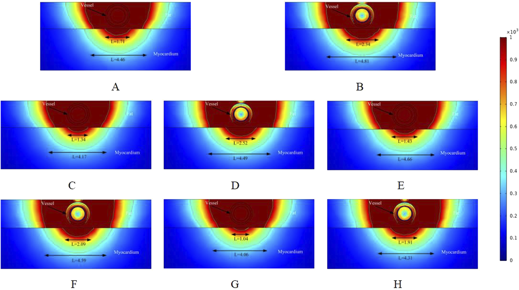 Color-coded heat maps labeled A to H display the vessel, fat, and myocardium layers. Each map shows measurements of L-values overlaid on the layers, with a vertical color scale ranging from zero to one point zero three on the right side.