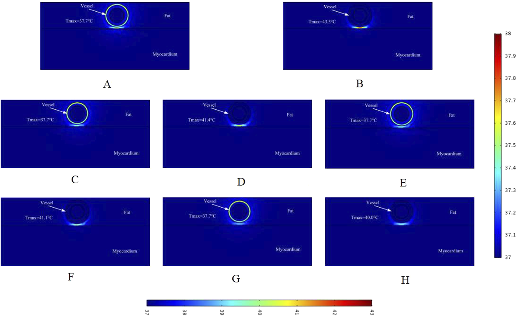 Thermal images labeled A to H show a vessel, fat, and myocardium with varying temperature maxima from 37.7 to 43.3 degrees Celsius, color-coded by a temperature scale.