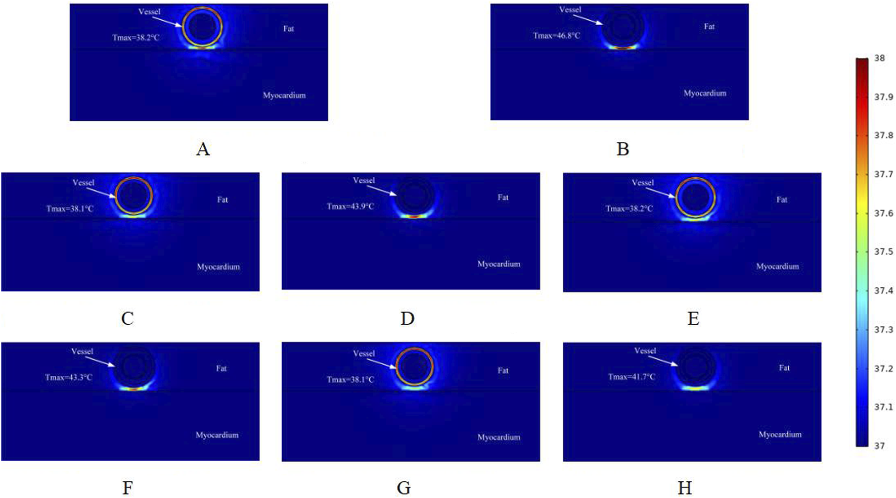 Thermal images labeled A to H show the cross-section of a tissue with a vessel, fat layer, and myocardium. The maximum temperatures for each image range from 38.1°C to 46.8°C, indicated next to the vessel. A color scale on the right shows temperature variations from 37°C to 38°C.