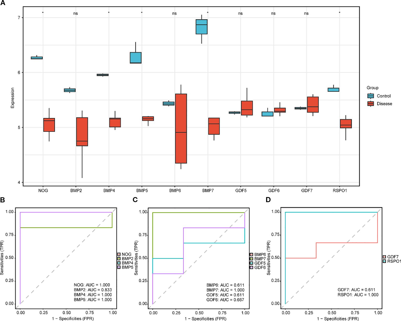 Chart A shows boxplots comparing expression levels of genes between control (blue) and disease (red) groups, with annotations for statistical significance. Charts B, C, and D are ROC curves for different genes, depicting sensitivity versus 1-specificity and displaying AUC values.