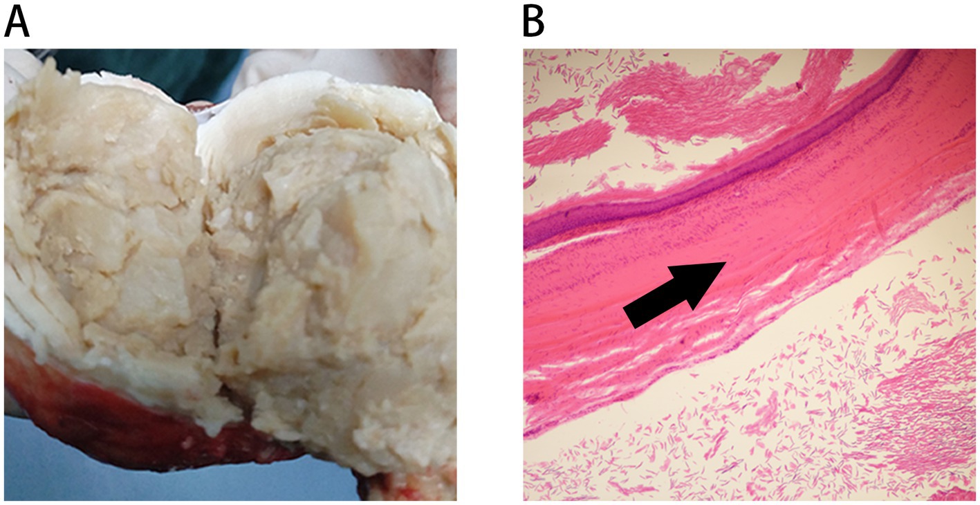 Panel A shows a cross-section of a yellowish, dense material resembling fatty tissue. Panel B is a histological image stained in pink, showing layers of tissue with a bold black arrow pointing at a particular structure.