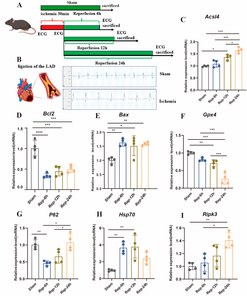 Diagram depicting experimental procedures and results of a cardiac study. Panel A describes the timeline of ischemia and reperfusion in mice, including details about ECG recordings and sacrifice times. Panel B illustrates LAD ligation on the heart and corresponding ECG results. Panels C to I display bar graphs comparing mRNA expression levels of six genes (Acsl4, Bcl2, Bax, Gpx4, P62, Hsp70, Ripk3) at different reperfusion times, indicating statistical significance with asterisks.