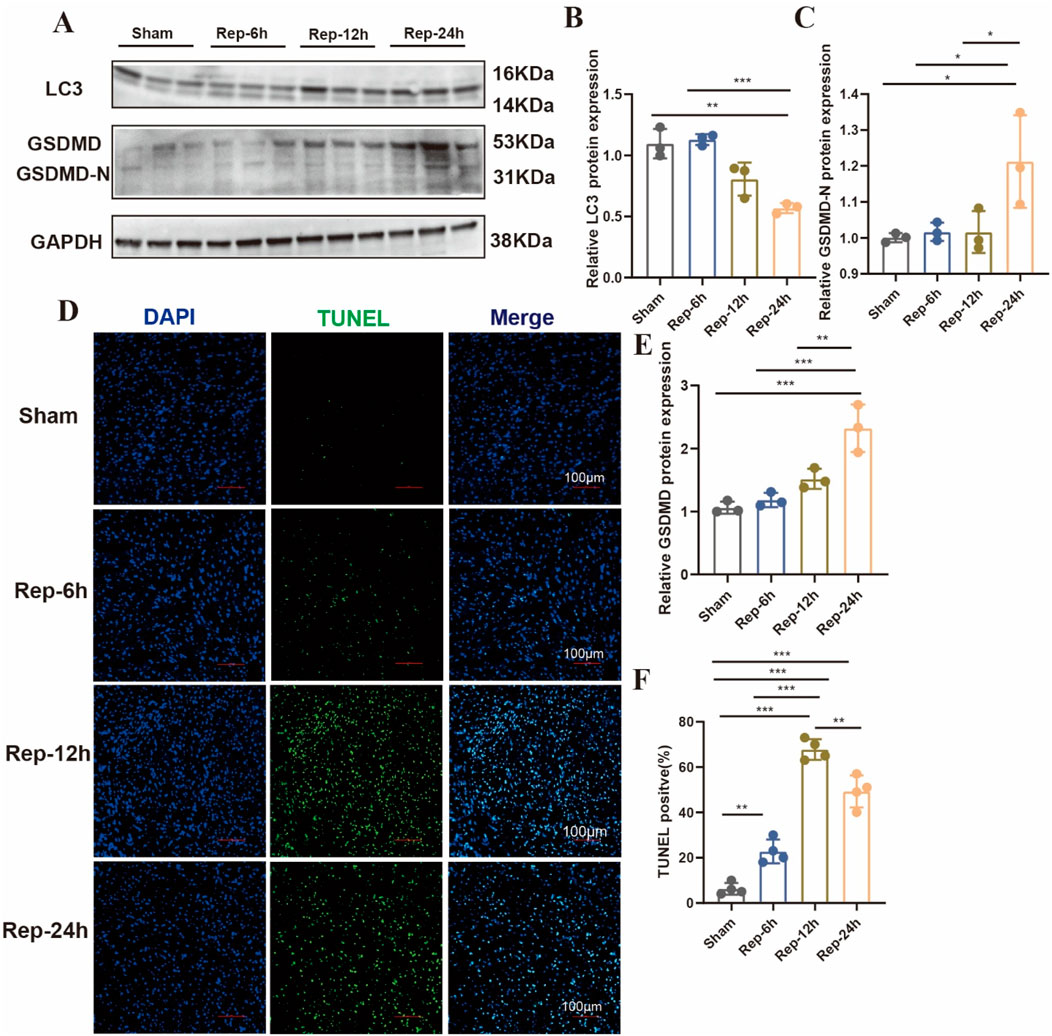 Western blot and bar graph analysis show protein expression levels of LC3, GSDMD, and GSDMD-N across sham, 6-hour, 12-hour, and 24-hour reperfusion groups. Confocal microscopy images depict DAPI, TUNEL, and merged staining of tissues at similar time points. Data reveal significant changes, with statistical indicators in bar graphs highlighting differences in protein expression and TUNEL positive cells between groups. Scale bars indicate 100 micrometers.