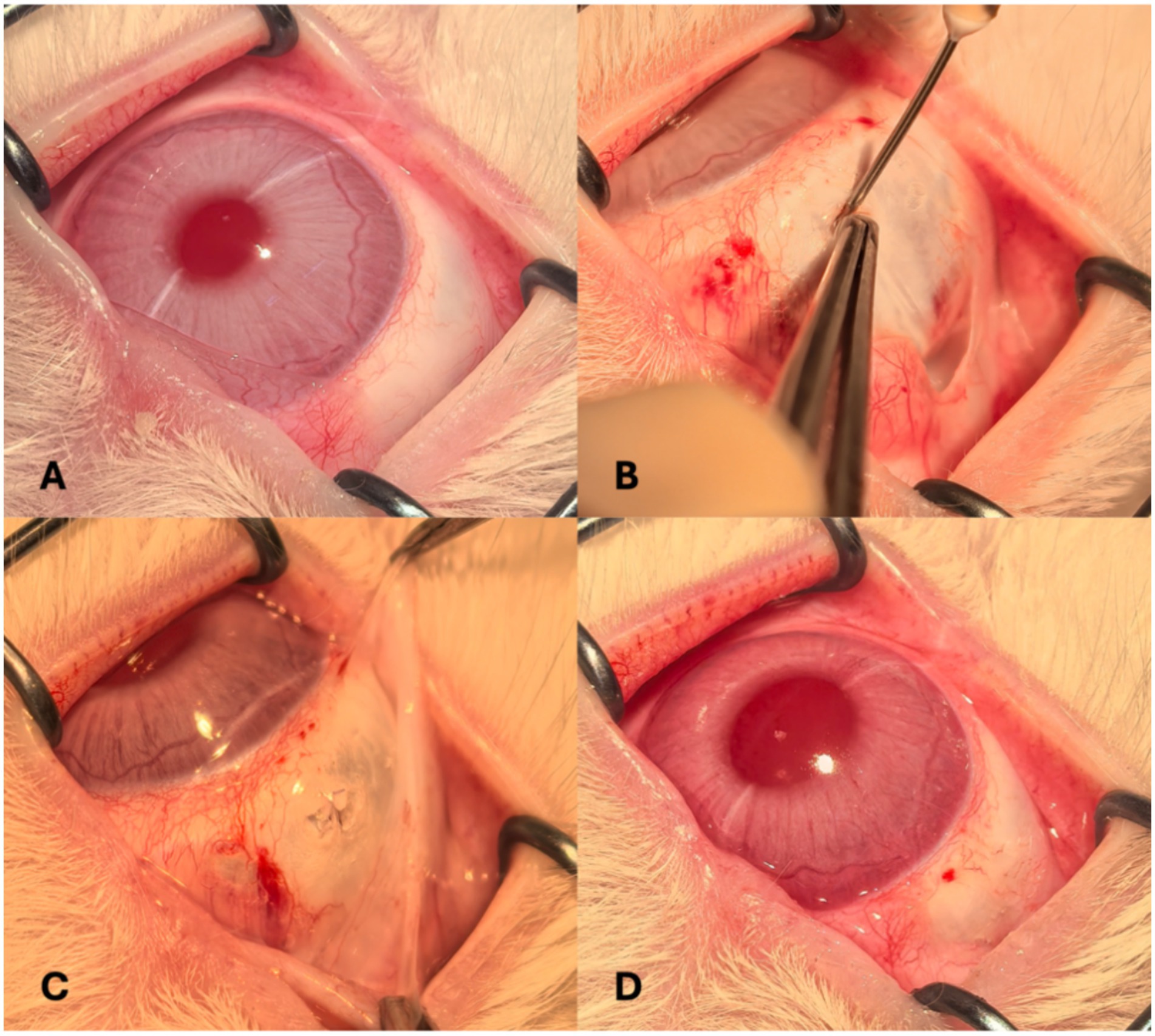 Four-panel image showing stages of an eye procedure. Panel A displays an eye held open with retractors. Panel B shows a surgical tool lifting a layer from the eye surface. Panel C depicts tissue removal. Panel D presents the eye post-procedure showing a clearer surface.