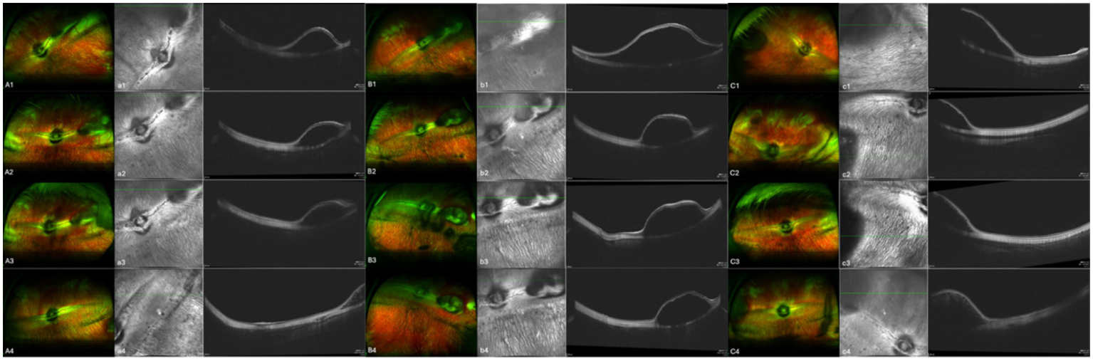A series of ophthalmic images arranged in four rows and columns labeled A, B, and C. Each column contains images showing different views and cross-sections of the eye, using various imaging techniques, including colored and grayscale views. The images appear to display details of the retina and other eye structures for diagnostic purposes.